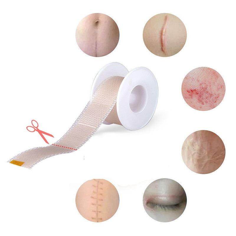 Uses of Healing Silicone Gel Scar Removal Film Tape